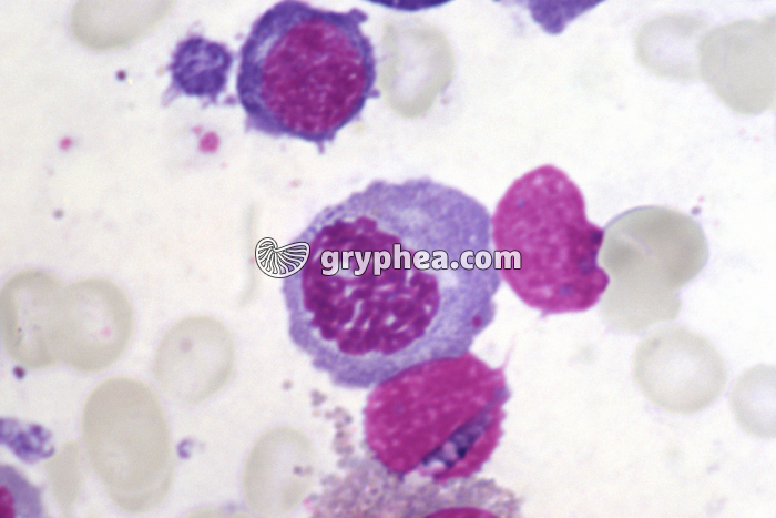 Moelle osseuse humaine cellules en mitose - prophase x400 - gryphea.com